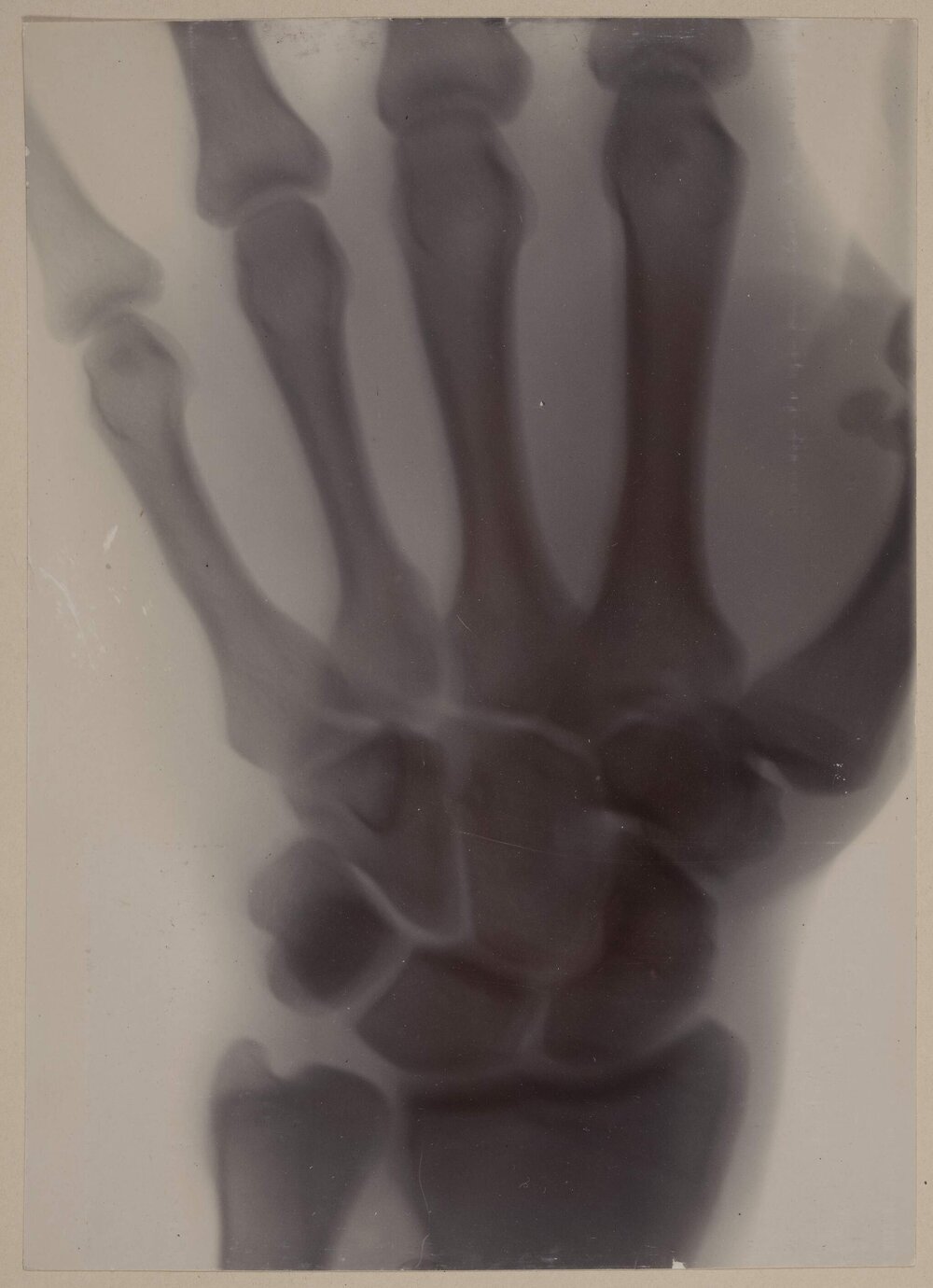 Taken at Melbourne University [X-ray]