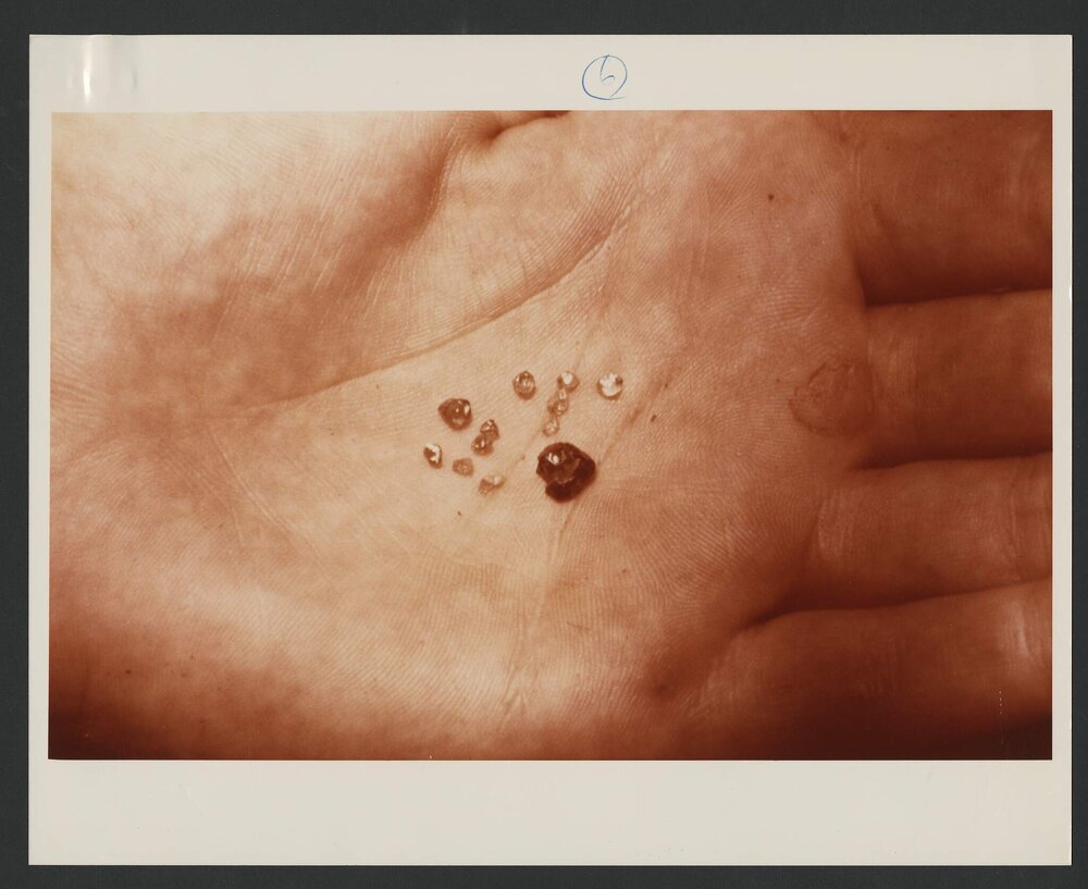 Ashton Joint Venture, Argyle Diamond