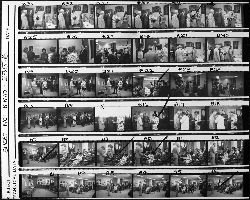 Otolaryngology - Bionic Ear